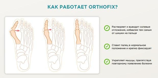 Как действует Orthofix